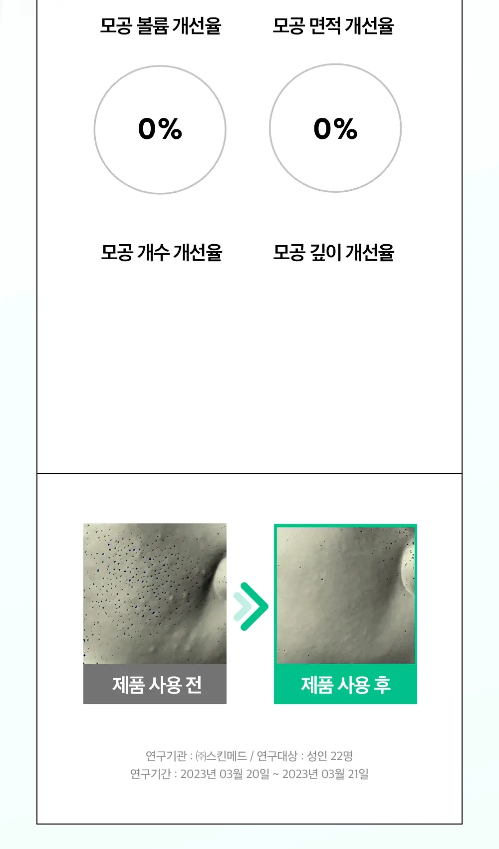 [각질/모공/피지] 듀이트리 AC컨트롤 딥 그린 카밍 클레이 젤 모공팩 100ml (기획/단품) 상세페이지 21